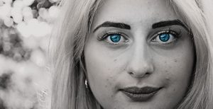 הזרקות חומצה היאלורונית